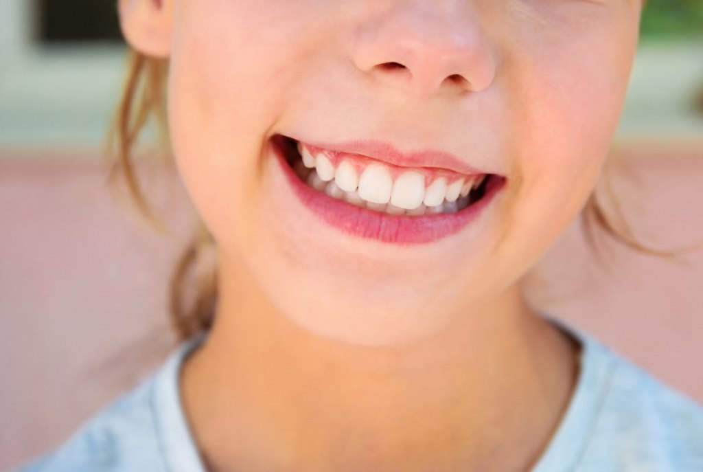 Whitening teeth photo AI effect result example
